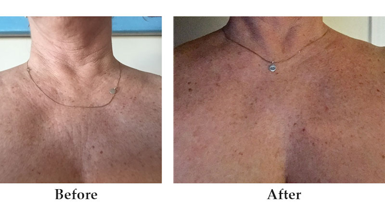 rejuvaluxe body nj
